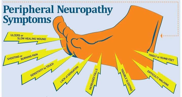 A visual showing common symptoms of alcoholic neuropathy.
