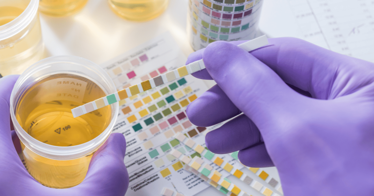 A forensics technician with purple, latex gloves on using fentanyl test strips in a lab setting. These are the latest harm reduction trend in addiction treatment.